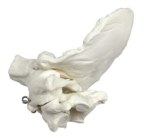 A134 placa occipital con atlantoaxial y pivote, tamaño natural.