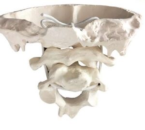 A139 2x Modelo de hueso occipital magnificado con atlantoaxial y pivote.