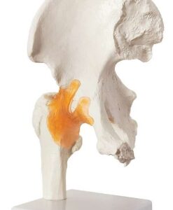 A204 Articulación de cadera con ligamentos funcionales, tamaño natural.