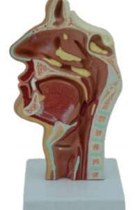 A7522 Modelo de nasofaringe patológica (rinitis), 1 pieza.