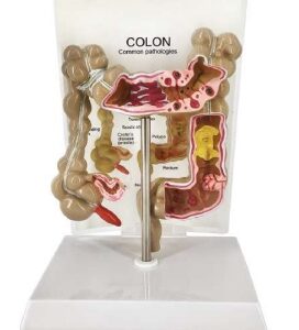 A745 Modelo patológico de colon y recto, ½ tamaño natural.