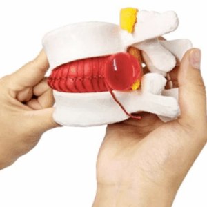 Modelos patológicos